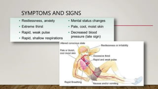 drug used in shock.pdf