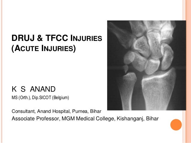 pics Tfcc Tear Mri https www slideshare net kumarsanand5 druj and tfcc injuries f