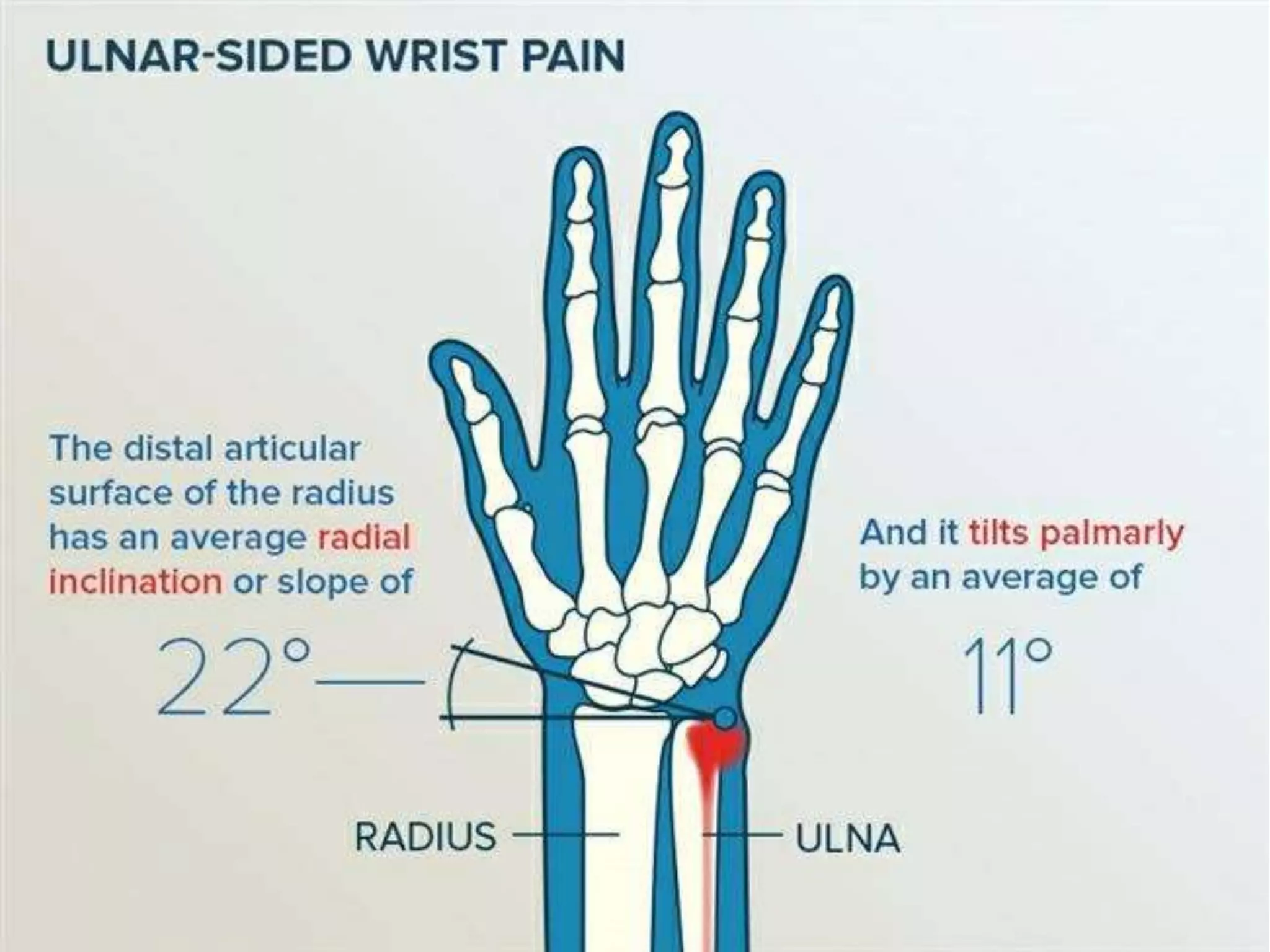 Distal Radioulnar Joint DRUJ Injuries PPTX