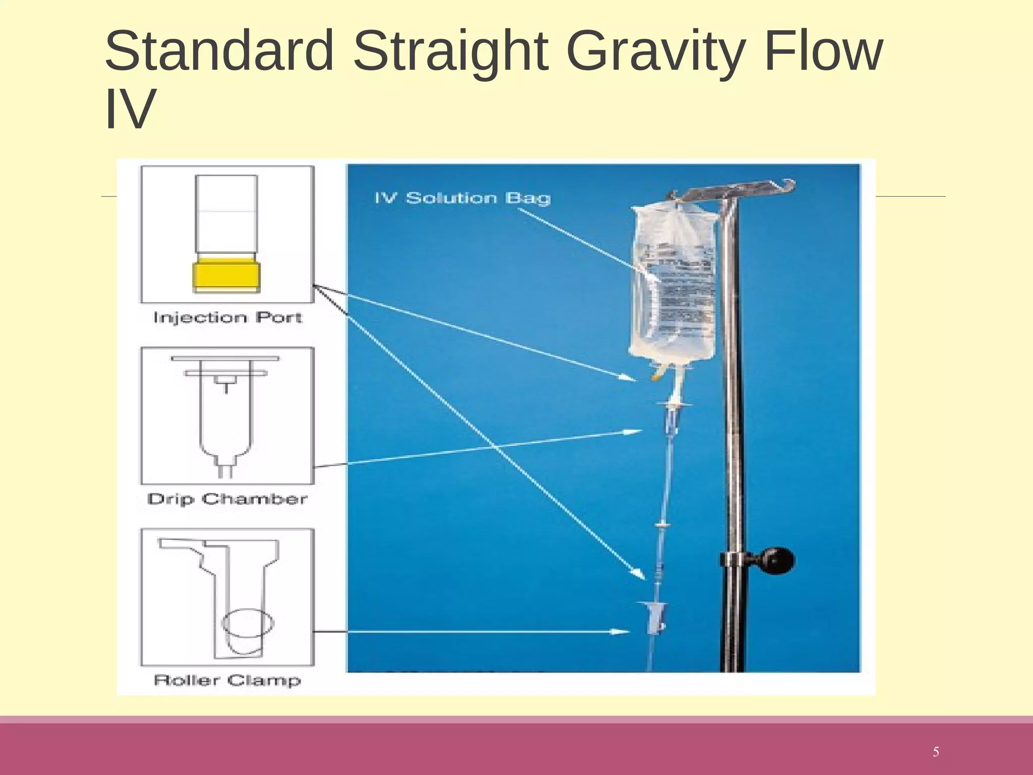 Standard Straight Gravity Flow
IV
5
 