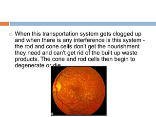  When this transportation system gets clogged up
and when there is any interference is this system -
the rod and cone cells don't get the nourishment
they need and can't get rid of the built up waste
products. The cone and rod cells then begin to
degenerate or die.
 
