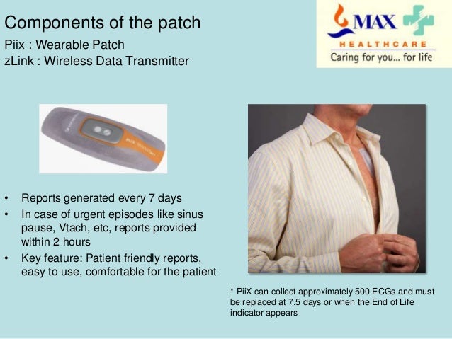 30 day heart monitor patch