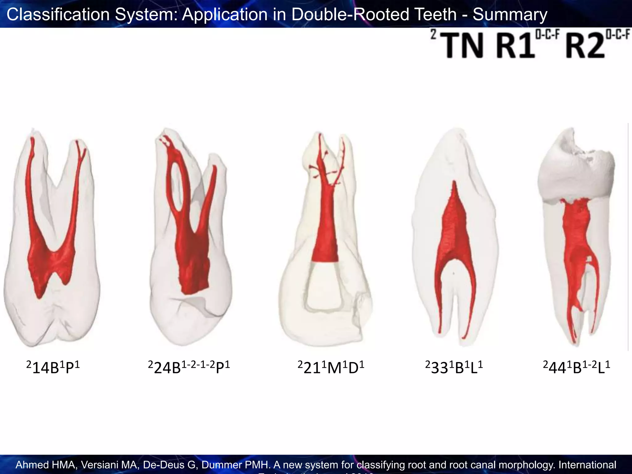 Root Canal Classification New Root Canal Classification System | PPTX