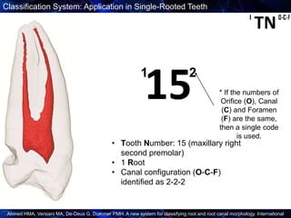 New Root Canal Classification System | PPTX