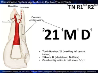 New Root Canal Classification System | PPTX