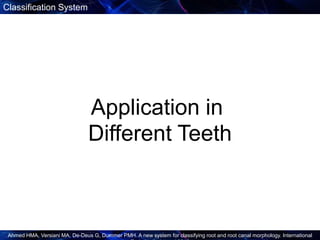 New Root Canal Classification System | PPTX