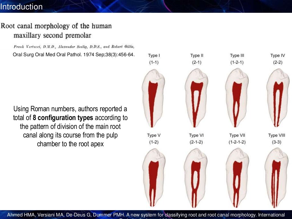New Root Canal Classification System