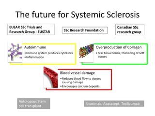 Current and future treatment option for Systemic Sclerosis | PDF