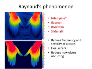 Current and future treatment option for Systemic Sclerosis | PDF