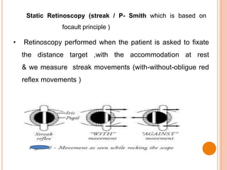 Static Retinoscopy (streak / P- Smith which is based on
focault principle )
• Retinoscopy performed when the patient is asked to fixate
the distance target ,with the accommodation at rest
& we measure streak movements (with-without-obligue red
reflex movements )
 