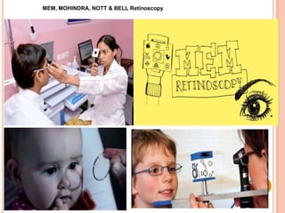 MEM, MOHINDRA, NOTT & BELL Retinoscopy
 