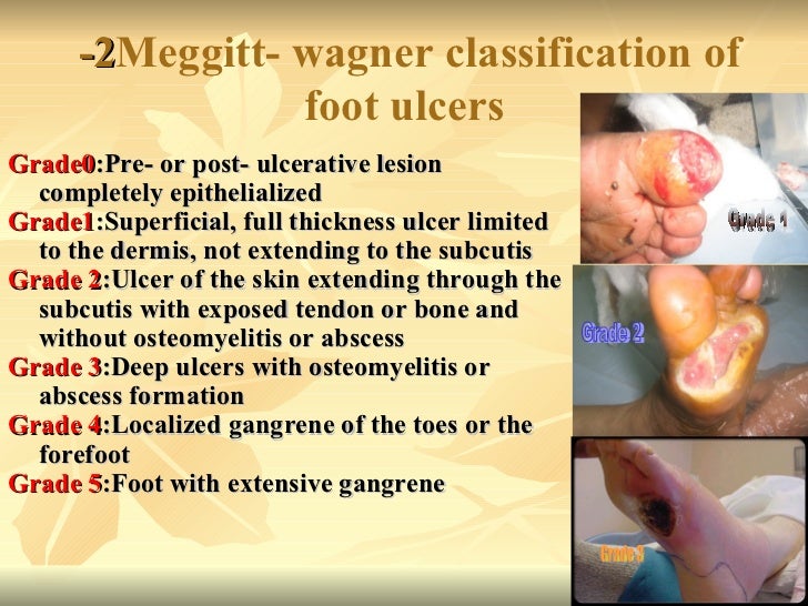 Predictors of the of diabetic foot ulcer at Assiut university…