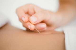 Procedure in Acupuncture