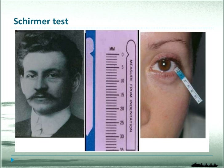 schirmer test