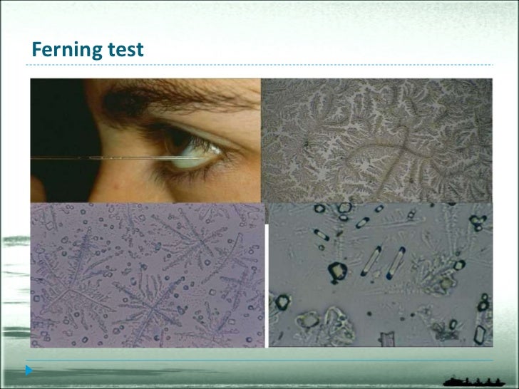 test eye y eye Dry test eye y eye Dry