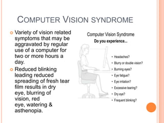 COMPUTER VISION SYNDROME
 Variety of vision related
  symptoms that may be
  aggravated by regular
  use of a computer for
  two or more hours a
  day.
 Reduced blinking
  leading reduced
  spreading of fresh tear
  film results in dry
  eye, blurring of
  vision, red
  eye, watering &
  asthenopia.
 