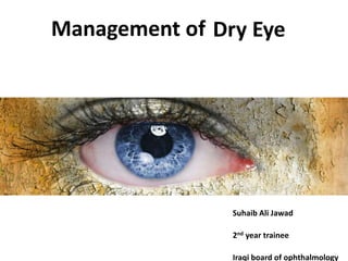 Management of Dry Eye
Suhaib Ali Jawad
2nd year trainee
Iraqi board of ophthalmology
 