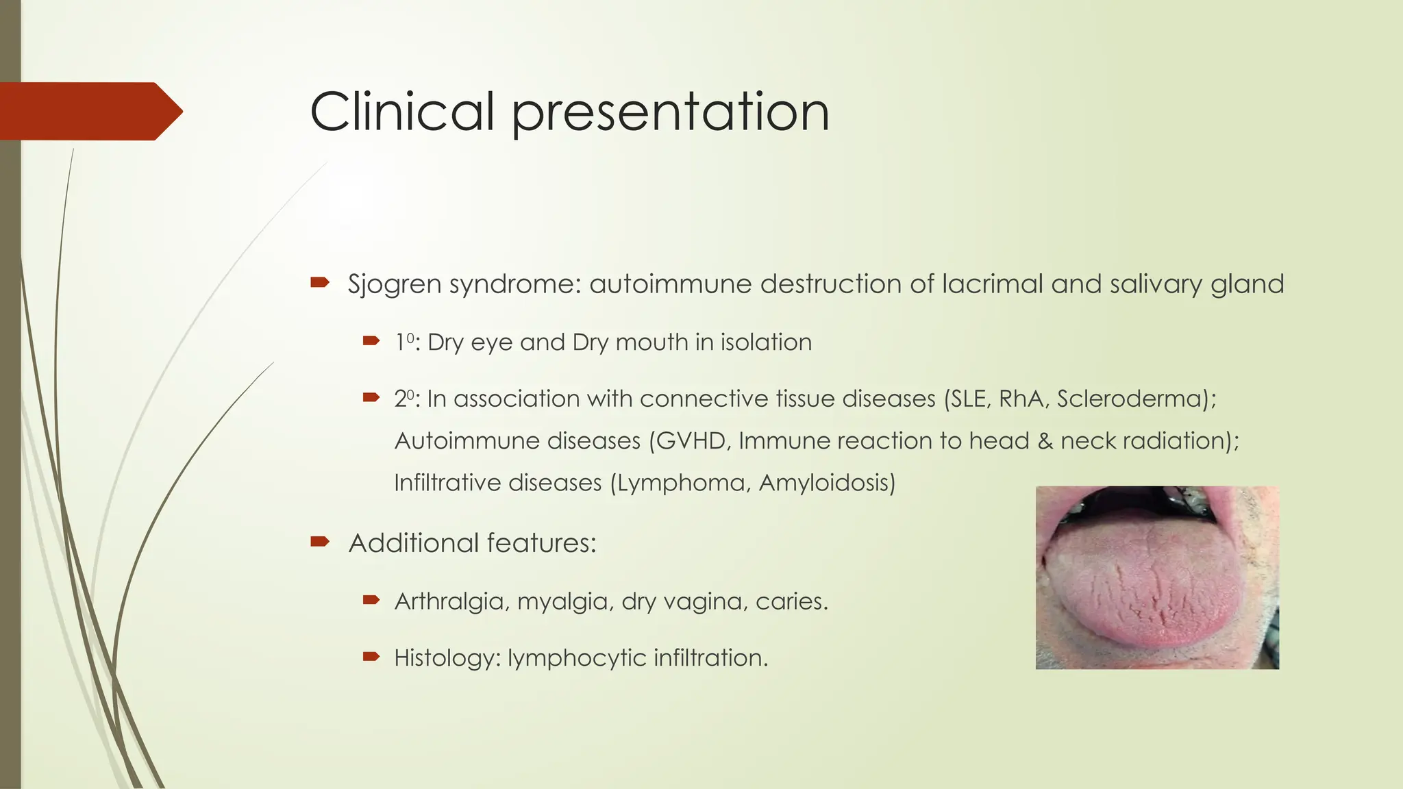 Investigations and Management of Dry Eye.pptx
