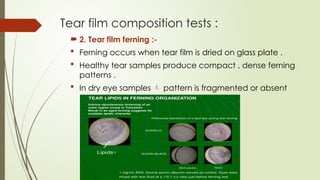 DRY EYE disease (DED) ophthalmology.pptx