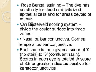  Rose Bengal staining – The dye has
an affinity for dead or devitalized
epithelial cells and for areas devoid of
mucus.
 Van Bijsterveld scoring system –
divide the ocular surface into three
zones:
 • Nasal bulbar conjunctiva, Cornea
Temporal bulbar conjunctiva.
 Each zone is then given a score of ‘0’
(no stain) to ‘3’ (confluent stain).
Scores in each eye is totaled. A score
of 3.5 or greater indicates positive for
keratoconjunctivitis
 