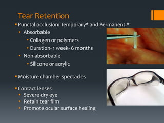 Dry eye evaluation and mx ppt | PPTX