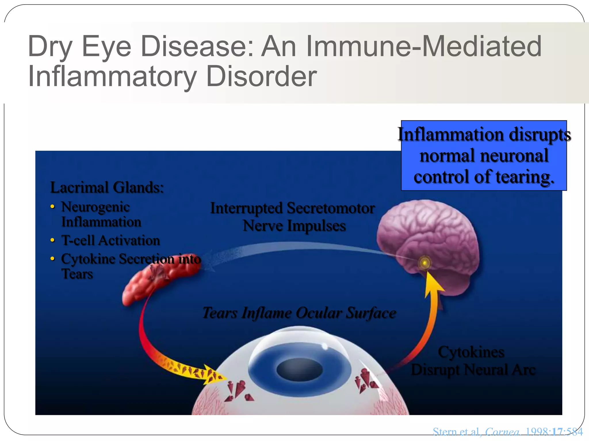 Captivating What Is Dry Eye Disease Photo Art Captivating What Is Dry Eye Disease Photo Art