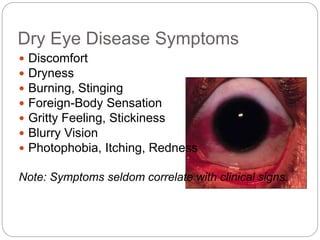 Dry Eye Disease Symptoms
 Discomfort
 Dryness
 Burning, Stinging
 Foreign-Body Sensation
 Gritty Feeling, Stickiness
 Blurry Vision
 Photophobia, Itching, Redness
Note: Symptoms seldom correlate with clinical signs.
 