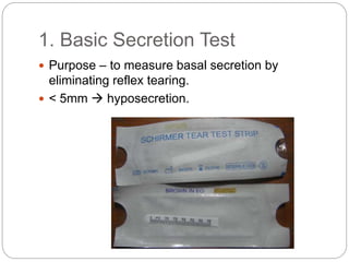 1. Basic Secretion Test
 Purpose – to measure basal secretion by
eliminating reflex tearing.
 < 5mm  hyposecretion.
 