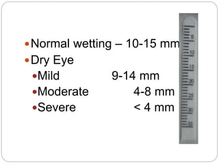 Normal wetting – 10-15 mm
Dry Eye
Mild 9-14 mm
Moderate 4-8 mm
Severe < 4 mm
 