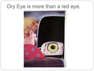 Dry Eye is more than a red eye.
 