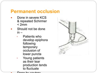 Permanent occlusion
 Done in severe KCS
& repeated Schirmer
< 2mm
 Should not be done
in –
 Patients who
develop epiphora
following
temporary
occlusion of
lower puncta
 Young patients
as their tear
production tends
to fluctuate
 