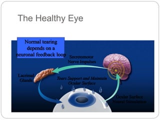 Lacrimal
Glands
Secretomotor
Nerve Impulses
Tears Support and Maintain
Ocular Surface
Ocular Surface
Neural Stimulation
The Healthy Eye
Normal tearing
depends on a
neuronal feedback loop
 