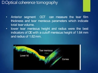D.Optical coherence tomography
• Anterior segment OCT can measure the tear film
thickness and tear meniscus parameters which indicate
total tearvolume.
• lower tear meniscus height and radius were the best
indicators of DEwith a cutoff meniscus height of 1.64 mm
and radius of 1.82mm.
 