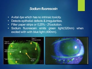 when
• Avital dye which hasno intrinsic toxicity.
• Detects epithelial defects & irregularities.
• Filter paper strips or 0.25%- 2%solution.
• Sodium fluorescein emits green light(520nm)
excited with with blue light (490nm).
Sodiumfluorescein
 