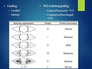 • Grading:
– Location
– Intensity
• NEIworkshopgrading:
– Cornea(Fluorescein) >3/15
– Conjunctiva(Rose-bengal)
>3/18
 