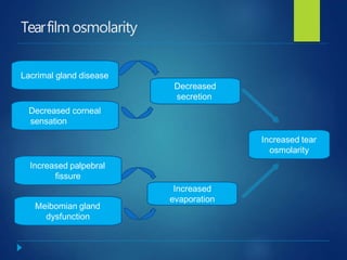 Tearfilm osmolarity
Lacrimal gland disease
Decreased corneal
sensation
Increased palpebral
fissure
Meibomian gland
dysfunction
Decreased
secretion
Increased
evaporation
Increased tear
osmolarity
 