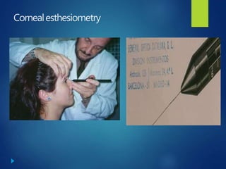 Cornealesthesiometry
 