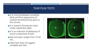 Comprehensive Overview of Dry Eye Disease: Causes, Diagnosis, and ...