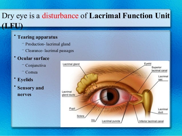 Dry Eye