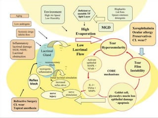 CAUSATIVE MECHANISM OF
DRY EYE
 
