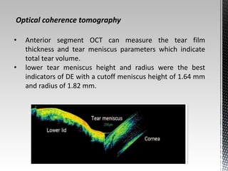 Optical coherence tomography 
• Anterior segment OCT can measure the tear film 
thickness and tear meniscus parameters which indicate 
total tear volume. 
• lower tear meniscus height and radius were the best 
indicators of DE with a cutoff meniscus height of 1.64 mm 
and radius of 1.82 mm. 
 