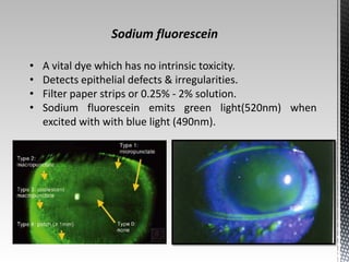Sodium fluorescein 
• A vital dye which has no intrinsic toxicity. 
• Detects epithelial defects & irregularities. 
• Filter paper strips or 0.25% - 2% solution. 
• Sodium fluorescein emits green light(520nm) when 
excited with with blue light (490nm). 
 