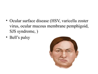 • Ocular surface disease (HSV, varicella zoster
virus, ocular mucous membrane pemphigoid,
SJS syndrome, )
• Bell’s palsy
 
