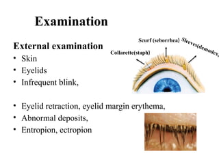 Examination
External examination
• Skin
• Eyelids
• Infrequent blink,
• Eyelid retraction, eyelid margin erythema,
• Abnormal deposits,
• Entropion, ectropion
Sleeves(demodex)
Scurf (seborrhea)
Collarette(staph)
 