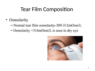 40
Tear Film Composition
• Osmolarity
– Normal tear film osmolarity-309-312mOsm/L
– Osmolarity >316mOsm/L is seen in dry eye
 