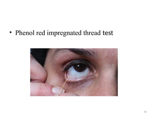 42
• Phenol red impregnated thread test
 