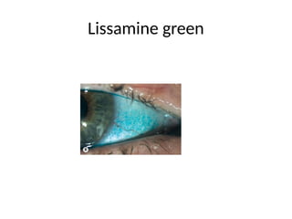Lissamine green
 