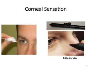 45
Corneal Sensation
Esthesiometer
 