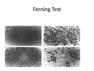 48
Ferning Test
 