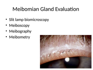55
Meibomian Gland Evaluation
• Slit lamp biomicroscopy
• Meiboscopy
• Meibography
• Meibometry
 